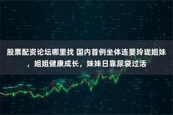 股票配资论坛哪里找 国内首例坐体连婴玲珑姐妹，姐姐健康成长，妹妹日靠尿袋过活